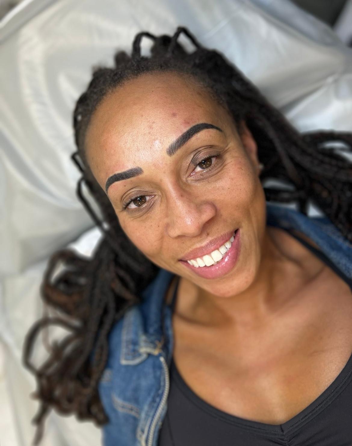 Brow result
